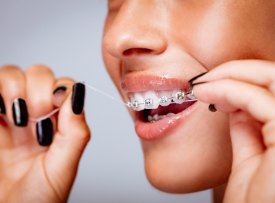 Nitkowanie zębów – dlaczego warto używać nici dentystycznej?